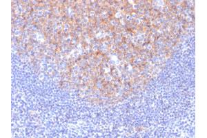 Formalin-fixed, paraffin-embedded human Tonsil stained with CD81 Mouse Monoclonal Antibody (1. (CD81 抗体)