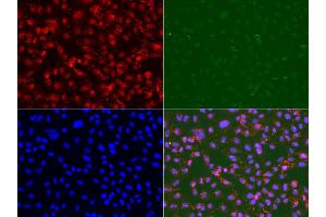 Immunofluorescence analysis of U2OS cell using RAD9A antibody.