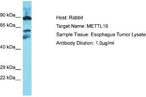 Host: Rabbit Target Name: METTL16 Sample Type: Esophagus Tumor lysates Antibody Dilution: 1.