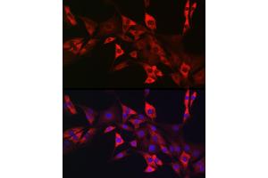Immunofluorescence analysis of NIH/3T3 cells using CD117/c-Kit antibody (ABIN6133454, ABIN6142896, ABIN6142898 and ABIN6213818) at dilution of 1:50. (KIT 抗体  (AA 25-295))
