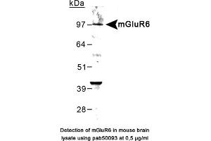 Image no. 1 for anti-Glutamate Receptor, Metabotropic 6 (GRM6) (C-Term) antibody (ABIN363402) (Metabotropic Glutamate Receptor 6 抗体  (C-Term))