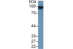 Western Blot; Sample: Rat Uterus lysate; Primary Ab: 1µg/ml Rabbit Anti-Rat MCAM Antibody Second Ab: 0. (MCAM 抗体  (AA 323-560))