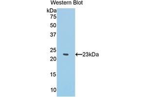 Western blot analysis of the recombinant protein. (IFNA 抗体  (AA 1-187))