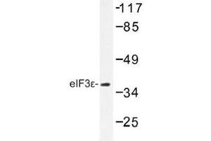 Image no. 1 for anti-Eukaryotic Translation Initiation Factor 3 Subunit E (EIF3E) antibody (ABIN317905) (EIF3E 抗体)
