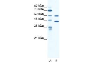 WB Suggested Anti-CATSPER2 Antibody Titration:  1. (CATSPER2 抗体  (C-Term))
