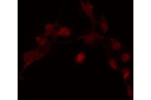 ABIN6274240 staining COLO205 cells by IF/ICC. (HOXD12 抗体  (Internal Region))