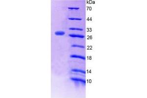 SDS-PAGE analysis of Human MED1 Protein. (MED1 蛋白)
