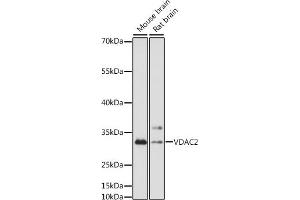 Western Blotting (WB) image for anti-Voltage-Dependent Anion Channel 2 (VDAC2) (AA 1-309) antibody (ABIN7271336)