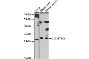 Western blot analysis of extracts of various cell lines, using C1GC1 antibody (ABIN6131024, ABIN6137748, ABIN6137749 and ABIN6223501) at 1:1000 dilution. (C1GALT1C1 抗体  (AA 30-190))