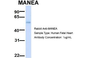 Host:  Rabbit  Target Name:  MANEA  Sample Type:  Human Fetal Heart  Antibody Dilution:  1. (MANEA 抗体  (Middle Region))