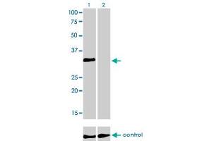 Western blot analysis of HOXC4 over-expressed 293 cell line, cotransfected with HOXC4 Validated Chimera RNAi (Lane 2) or non-transfected control (Lane 1). (HOXC4 抗体  (AA 160-264))