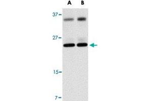 Western blot analysis of THEM4 in human liver tissue lysate with THEM4 polyclonal antibody  at (A) 1 and (B) 2 ug/mL . (THEM4 抗体  (Internal Region))