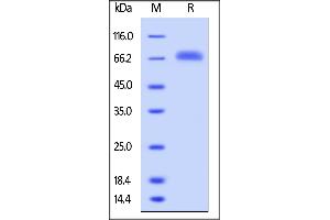 Human LILRB5, His Tag on  under reducing (R) condition. (LILRB5 Protein (AA 24-458) (His tag))