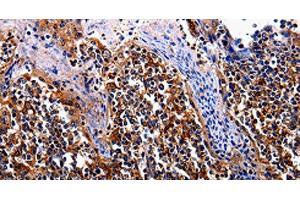 Immunohistochemistry of paraffin-embedded Human tosil tissue using IL17RC Polyclonal Antibody at dilution 1:30