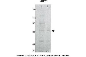 Lanes:   1. (AKT1 抗体  (N-Term))