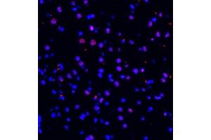 Immunofluorescence of paraffin embedded mouse brain using ZNF682 (ABIN7076270) at dilution of 1:400 (400x lens) (ZNF682 抗体)