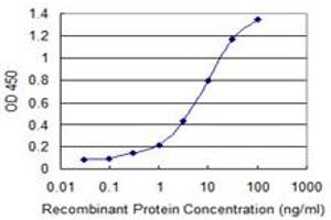 Detection limit for recombinant GST tagged CBX1 is 0. (CBX1 抗体  (AA 2-99))