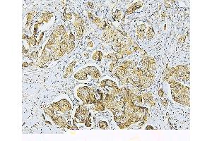 IHC analysis of NF2 using anti-NF2 antibody (ABIN7600115).