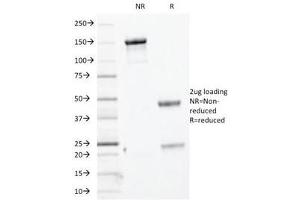 SDS-PAGE Analysis of Purified, BSA-Free Basic Cytokeratin Antibody (clone KRTH/1076). (Keratin Basic 抗体)