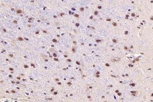 Immunohistochemistry analysis of paraffin-embedded ratsubstantia nigrausing PARC (ABIN7073606) at dilution of 1:1200 (CUL9 抗体)