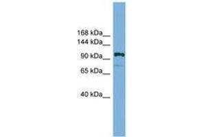 Image no. 1 for anti-HIR Histone Cell Cycle Regulation Defective Homolog A (HIRA) (AA 601-650) antibody (ABIN6744564) (HIRA 抗体  (AA 601-650))