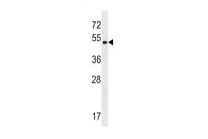 Western blot analysis in A2058 cell line lysates (35ug/lane). (ZNF559 抗体  (AA 196-224))