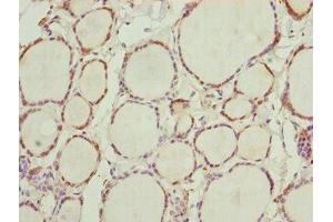 Immunohistochemistry of paraffin-embedded human thyroid tissue using ABIN7161775 at dilution of 1:100 (NFIL3 抗体  (AA 133-462))