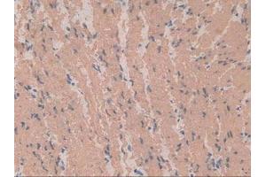 Immunohistochemistry (IHC) image for anti-Actin, alpha 2, Smooth Muscle, Aorta (ACTA2) (AA 167-377) antibody (ABIN7439306)