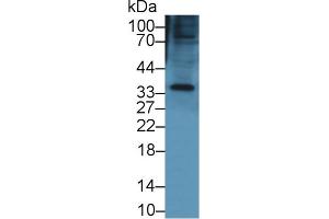 Western blot analysis of Mouse Small intestine lysate, using Mouse KERA Antibody (1 µg/ml) and HRP-conjugated Goat Anti-Rabbit antibody ( (KERA 抗体  (AA 21-292))