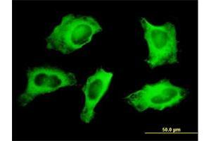 Immunofluorescence of monoclonal antibody to MYH9 on HeLa cell. (Myosin 9 抗体  (AA 131-220))