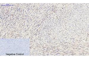 Immunohistochemical analysis of paraffin-embedded human uterus tissue. (SYN1 抗体)