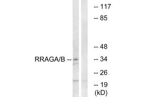 Western blot analysis of extracts from HepG2 cells, using RRAGA/B antibody. (RRAGA/B 抗体  (C-Term))