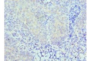 Immunohistochemistry of paraffin-embedded human tonsil tissue using ABIN7146923 at dilution of 1:100 (CARD8 抗体  (AA 1-200))
