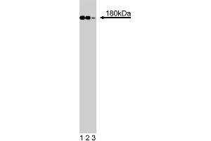 Western blot analysis of IRS-1 on RSV-3T3 cell lysate. (IRS1 抗体  (AA 1131-1234))