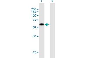 Western Blot analysis of MON1B expression in transfected 293T cell line by MON1B MaxPab polyclonal antibody. (MON1B 抗体  (AA 1-547))