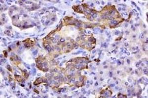 Immunohistochemistry (Paraffin-embedded Sections) (IHC (p)) image for anti-omega-3 Fatty Acid Receptor 1 (O3FAR1) antibody (ABIN7074942)