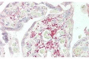 Detection of Slit2 in Human Placenta Tissue using Polyclonal Antibody to Slit Homolog 2 (Slit2) (SLIT2 抗体  (AA 1160-1333))