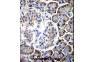 SMAP2 Antibody immunohistochemistry analysis in formalin fixed and paraffin embedded human pancreas tissue followed by peroxidase conjugation of the secondary antibody and DAB staining. (SMAP2 抗体  (AA 111-140))