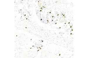 Immunohistochemistry analysis of paraffin-embedded rat skinusing Chymase (ABIN7073506) at dilution of 1:1000 (CMA1 抗体)