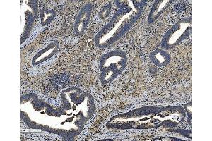 IHC analysis of Integrin beta 5/ITGB5 using anti-Integrin beta 5/ITGB5 antibody (ABIN7601319).