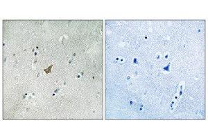 Immunohistochemistry (IHC) image for anti-EPH Receptor A3 (EPHA3) (pTyr779), (pTyr833) antibody (ABIN1847593) (EPH Receptor A3 抗体  (pTyr779, pTyr833))