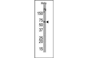 Image no. 1 for anti-Promyelocytic Leukemia (PML) (Sumoylation Site) antibody (ABIN357734) (PML 抗体  (Sumoylation Site))