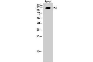 Western Blotting (WB) image for anti-PTK2 Protein tyrosine Kinase 2 (PTK2) (Thr446) antibody (ABIN3184583) (FAK 抗体  (Thr446))