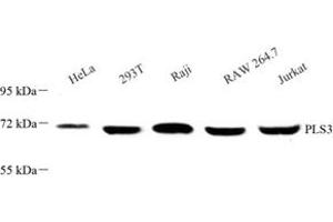 Western blot analysis of PLS3 (ABIN7075097) at dilution of 1: 500 (Plastin 3 抗体)