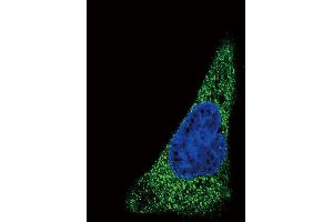 Immunofluorescence (IF) image for anti-Solute Carrier Family 11 (Proton-Coupled Divalent Metal Ion Transporters), Member 2 (SLC11A2) (AA 262-291) antibody (ABIN657723)