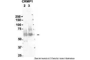 Sample Type: 2. (CRMP1 抗体  (N-Term))