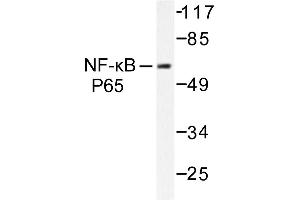 Image no. 1 for anti-Nuclear Factor-kB p65 (NFkBP65) antibody (ABIN271749) (NF-kB p65 抗体)
