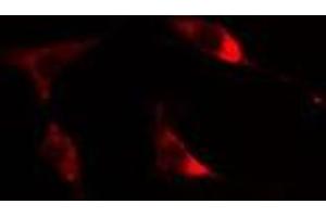 ABIN6275600 staining Hela cells by IF/ICC. (Sorting Nexin 1 抗体  (Internal Region))
