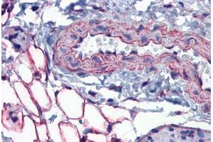Mouse Vessel and Adipocytes: Formalin-Fixed, Paraffin-Embedded (FFPE) (PTRF 抗体  (AA 177-226))