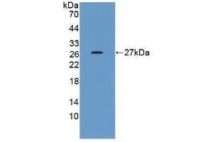 Western blot analysis of the recombinant protein. (HSP27 抗体  (AA 2-205))